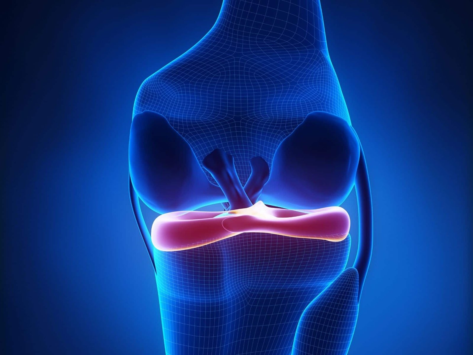 Infiammazione Menisco Cosa Devo Fare FisioScience Medical