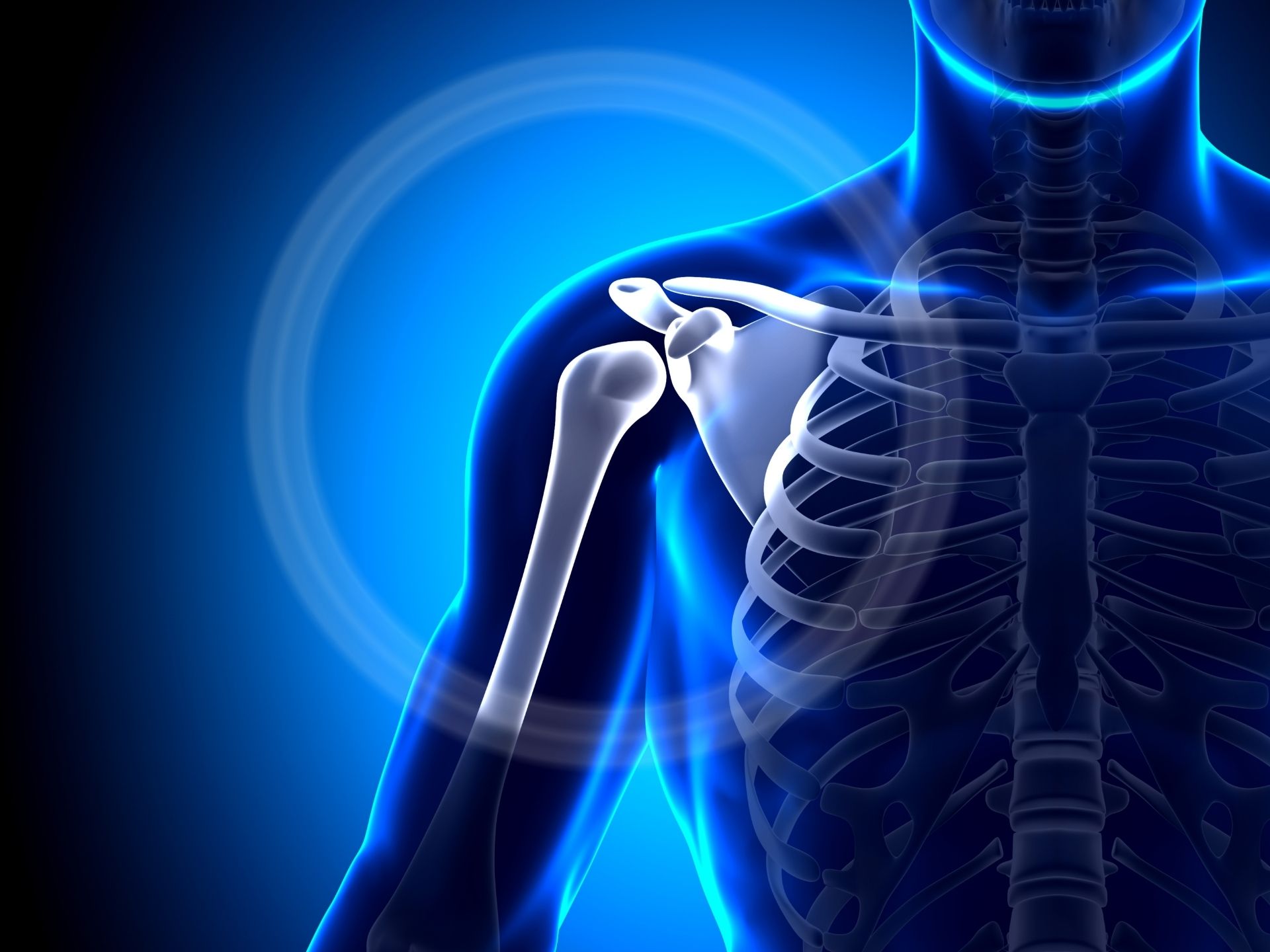 перелом лопатка анатомия. плечелопаточный периартрит травматология. остеохондроз плечевого сустава симптомы и лечение. хрустит плечевой сустав. остеохондроз плечевого сустава симптомы и лечение.